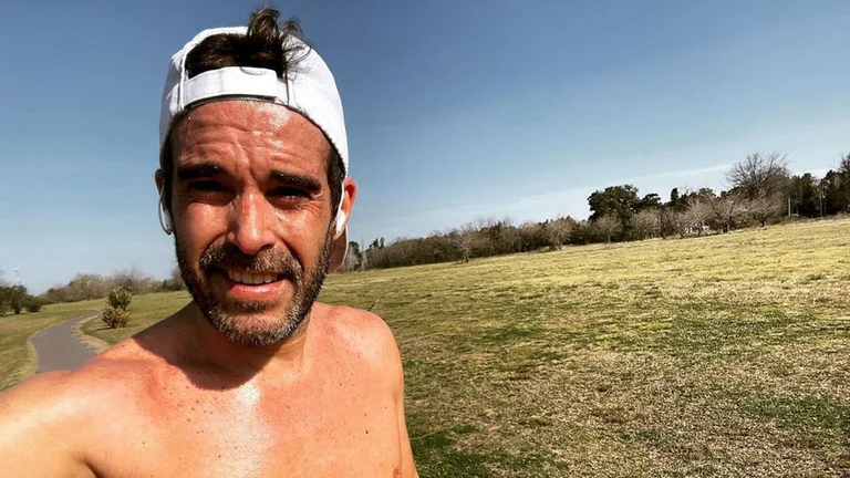 Nicolás Cabré fue operado de una de sus rodillas: qué fue lo que le pasó