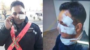 Agredieron a dos policías a metros de la Jefatura Central: uno de ellos quedó internado