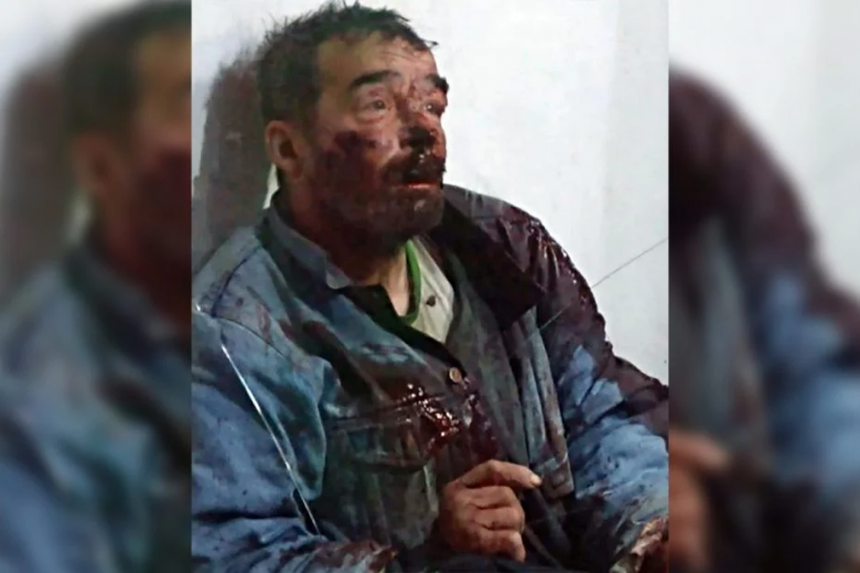 Un pedido desesperado: robaron y golpearon salvajemente a un indigente en San Luis