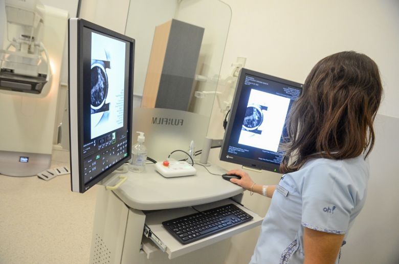 DOSEP lanza el programa de Prevención de Cáncer de Mama y Cáncer de Cuello de Útero