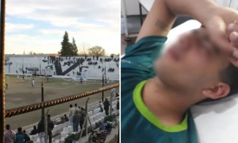 Violencia en un partido de fútbol en Villa Mercedes: le quebraron la mandíbula a un jugador