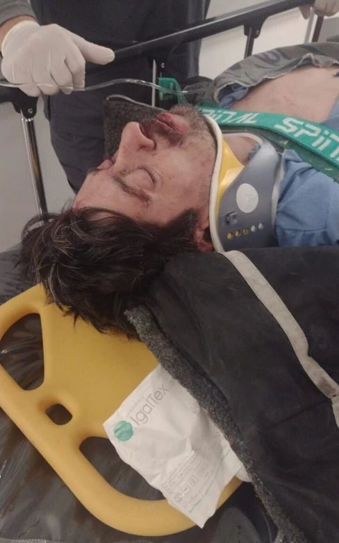 Robó, huyó, volcó y terminó detenido e internado en el hospital