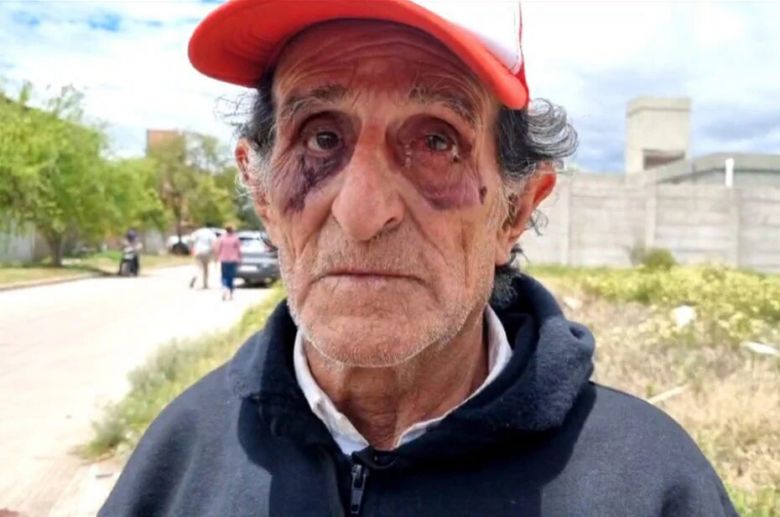 Villa Mercedes: Salvaje golpiza a un jubilado para robarle 