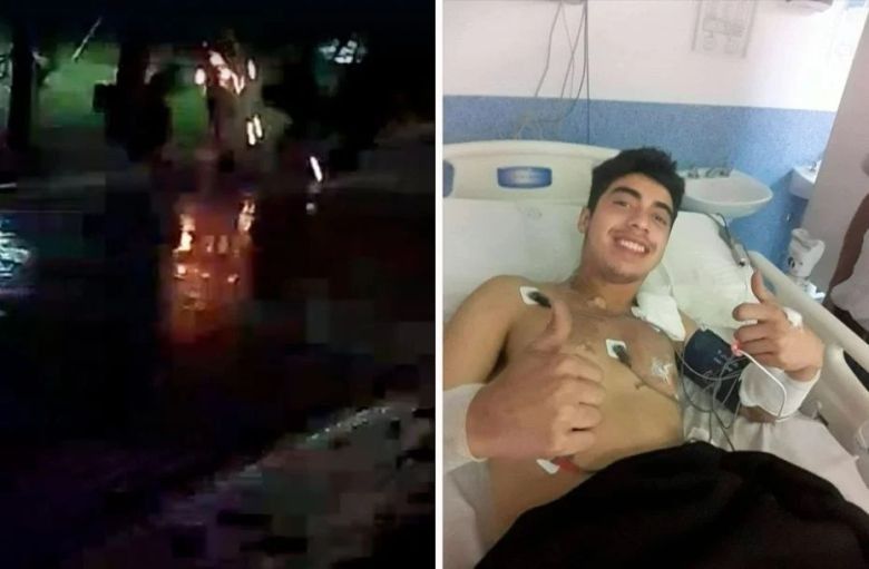 Un rayo cayó sobre un hombre en San Luis y le quemó el 20% del cuerpo 