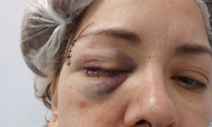 Salvaje intento de femicidio en Villa Mercedes