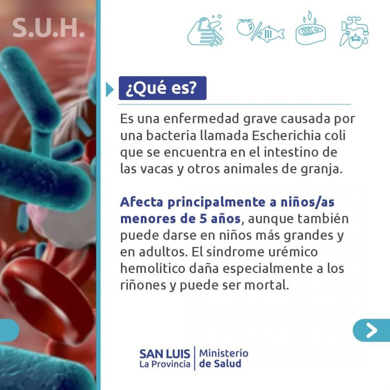Lanzan recomendaciones para prevenir el S&iacute;ndrome Ur&eacute;mico Hemol&iacute;tico (SUH)