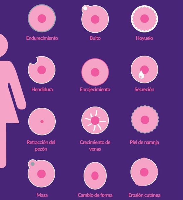 Estos son lo síntomas del cáncer de mama: no los debes dejar pasar